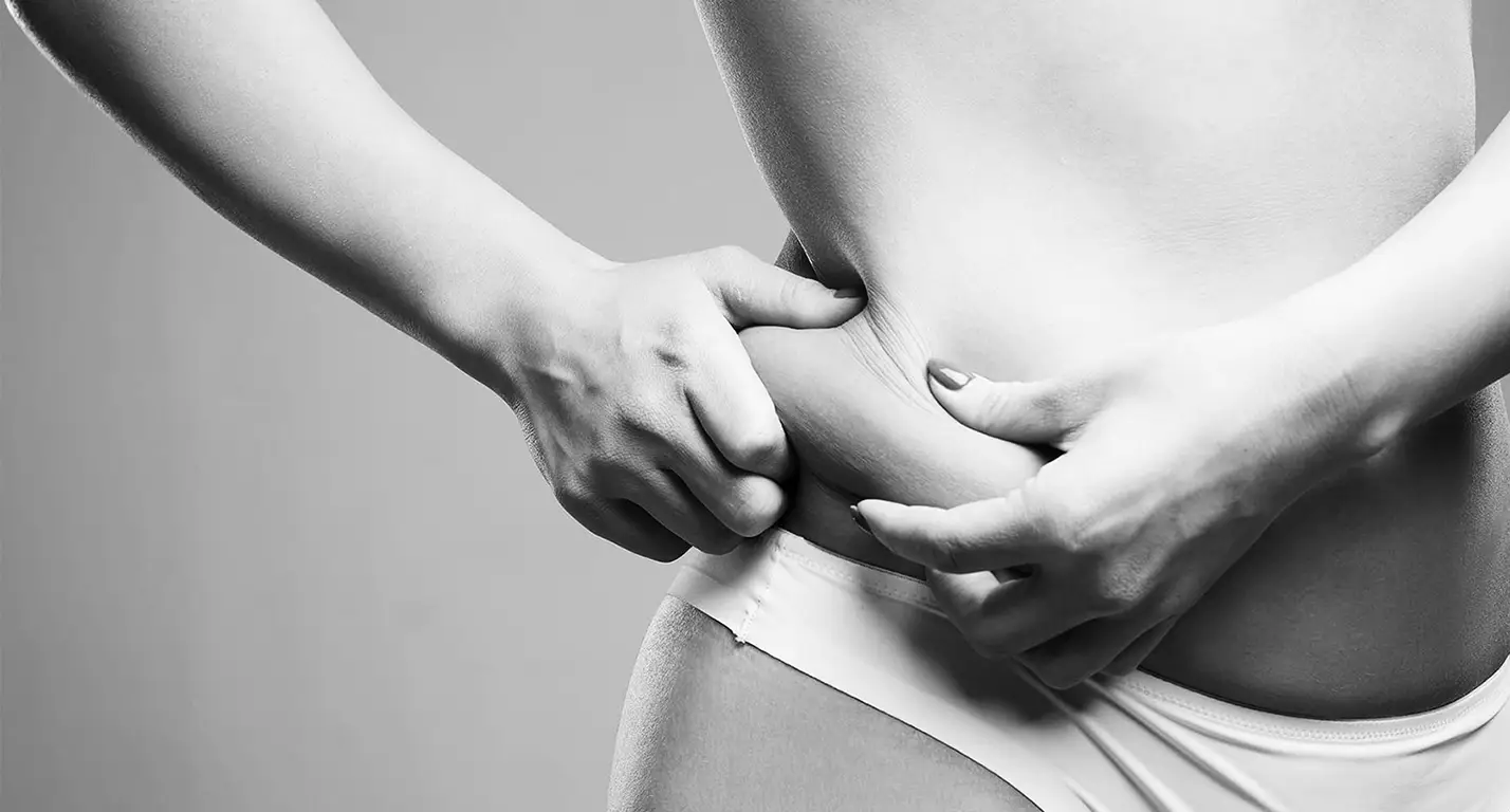 FOR FIGURE PROBLEMS LIPOSUCTION/LIPOSUCTION/BODY CONTOURING