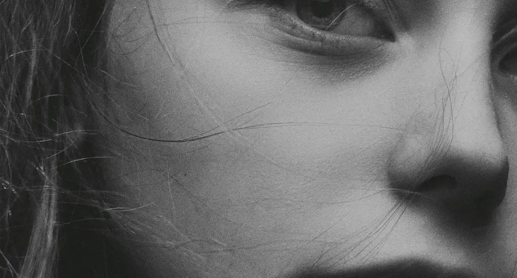 RENUVION — A MODERN METHOD OF SKIN TIGHTENING