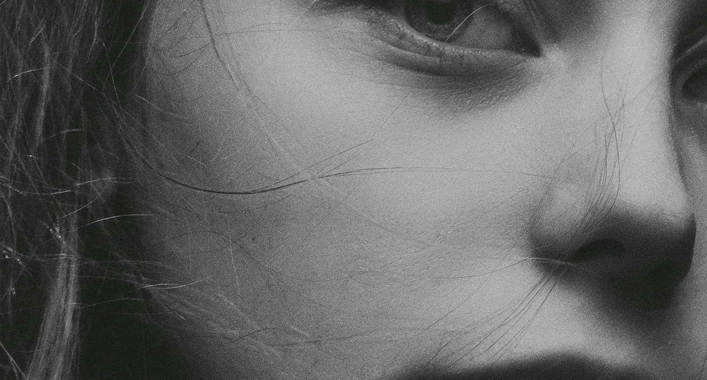RENUVION — A MODERN METHOD OF SKIN TIGHTENING