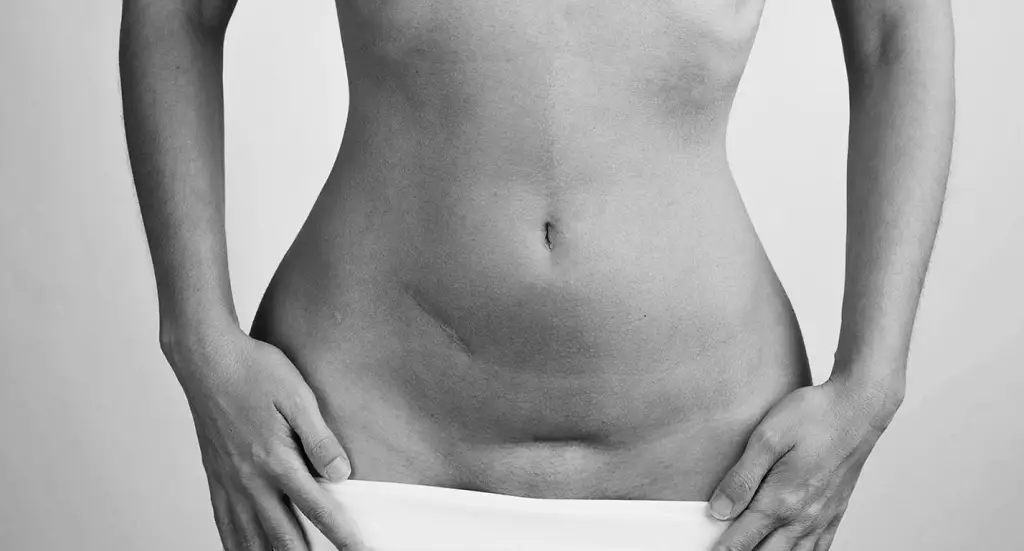 IMPROVE UNSIGHTLY SURGICAL RESULTS? CORRECTION OPERATIONS