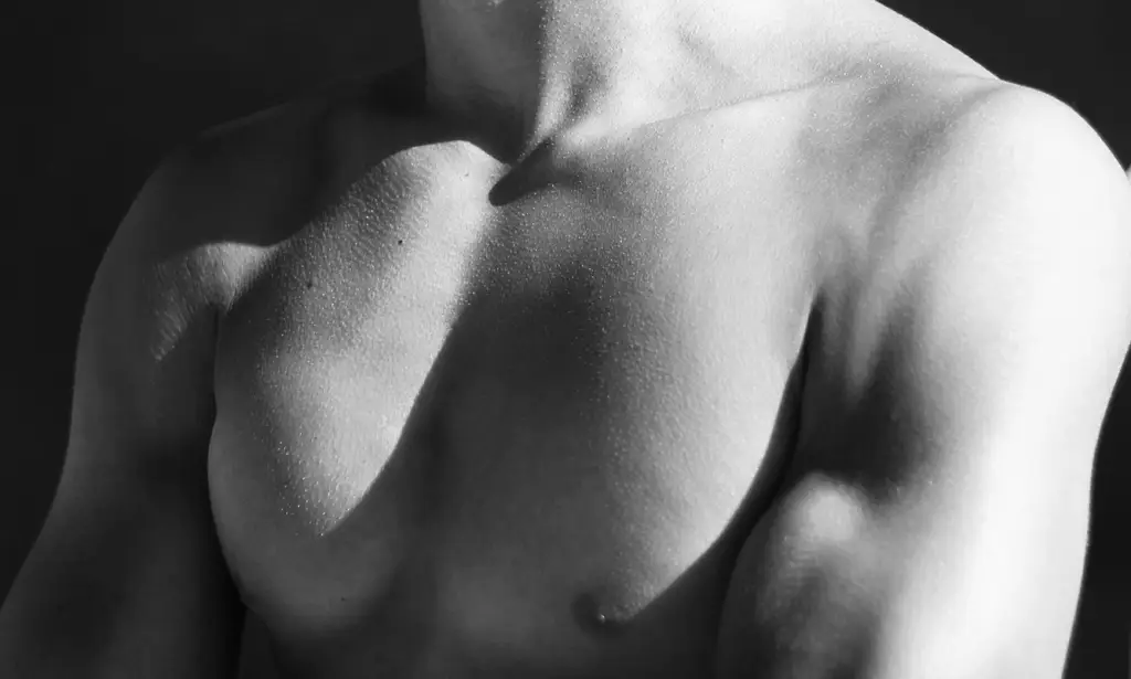 SCULPTRA - AN INNOVATIVE PROCEDURE FOR VOLUME RESTORATION AND SKIN REJUVENATION