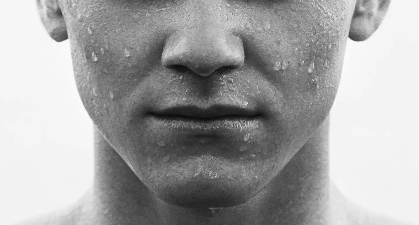 BOTULINUM TOXIN FOR A FRESHER LOOK