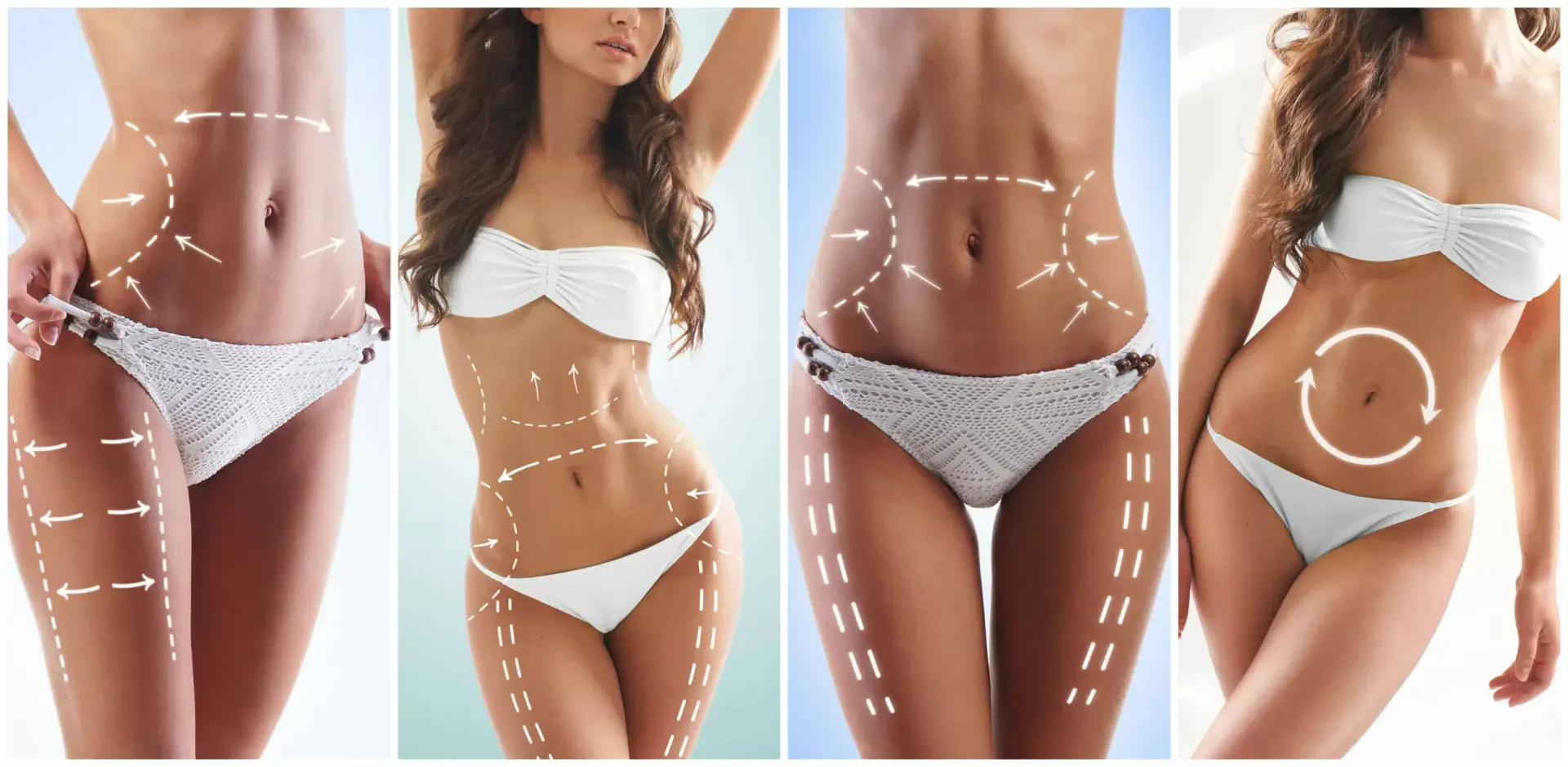 Liposuction results